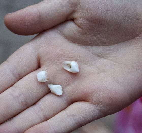 Carl Jung on the Symbol of Losing Teeth 13 23346 teeth